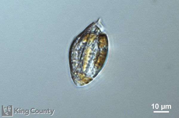 Photo of Torodinium cf. robustum